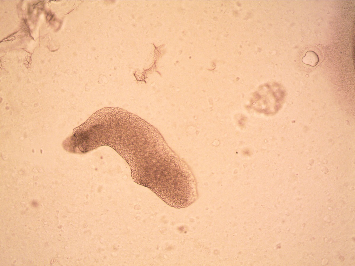 amoeba